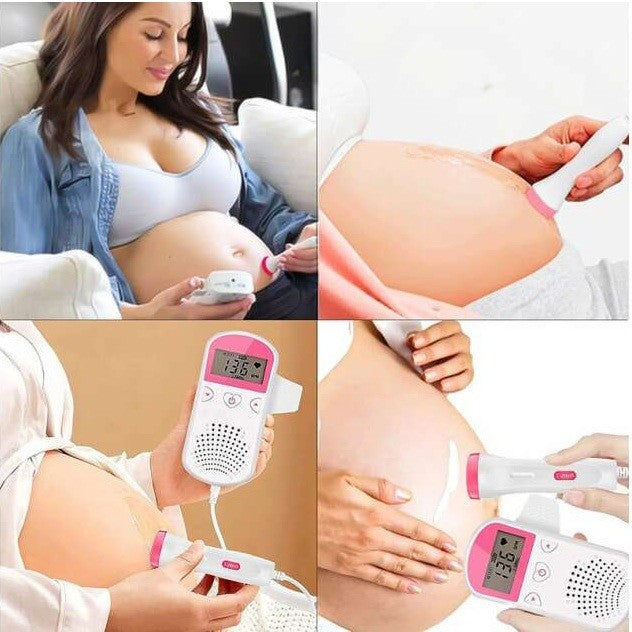 Monitor Fetal Doppler Portabil, Dispozitiv Ascultare Bătăi Inimă Bebeluș, Sondă Impermeabilă 3.0 MHz, Ecran LCD 4.5 cm, Ritm Cardiac 50-230 BPM, Material ABS, 12.8 x 9.6 x 3 cm, Alb/Roz