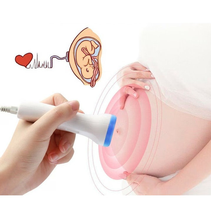 Monitor Fetal Doppler Portabil, Dispozitiv Ascultare Bătăi Inimă Făt, Ecran LCD 4.5 cm, Sondă Impermeabilă 3.0 MHz, Utilizare de la 9 Săptămâni, Material ABS, Albastru